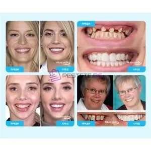 Декоративни изкуствени зъби Snap on Smile